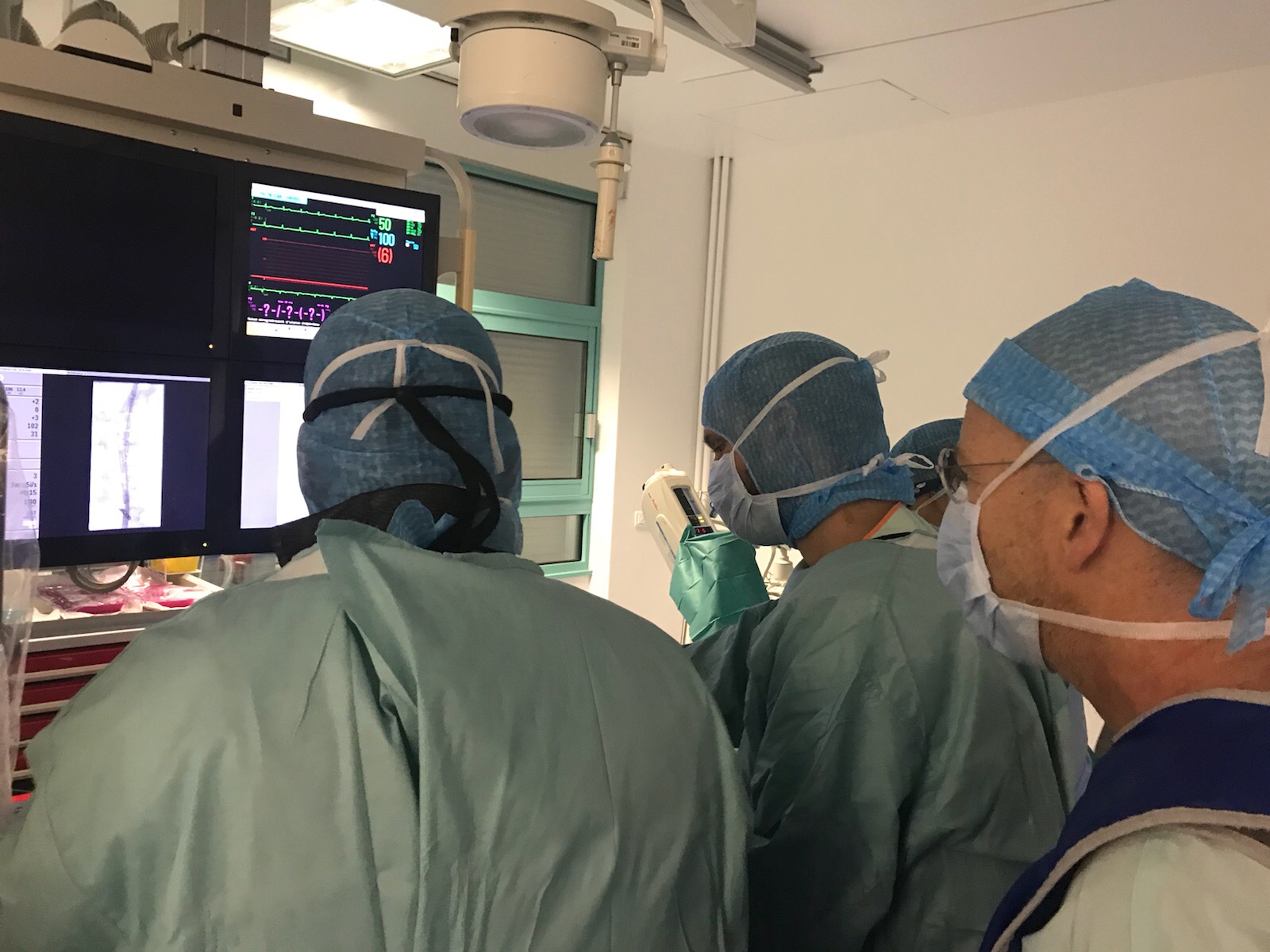 Première pose d’une endoprothèse aortothoracoabdominale « fenêtrée » au GHR Mulhouse Sud